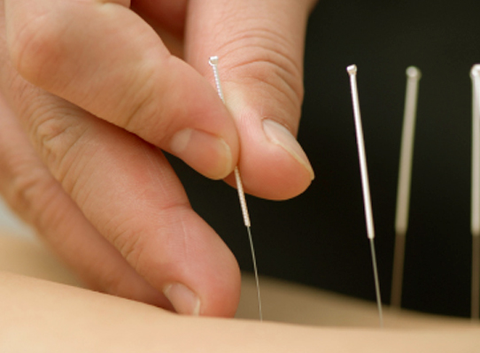 针灸保健