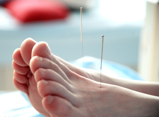 足痛针灸治疗
